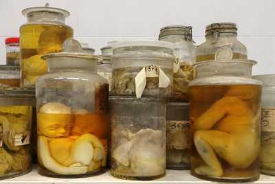 Organi malati e feti malformati: nel Policlinico potrebbe nascere il "museo del materiale anatomico"